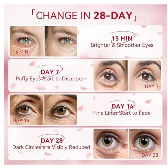 NWT Rose Eye Mask– 60 Pcs, Under Eye Patches,Eye Patches For Puffy Eyes,Hydrate - Picture 9 of 10